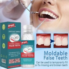 Teeth Glue Dental Tooth Repair Kit Moldable Tooth Broken Teeth Gaps Repair Resin