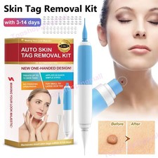 2in1 Painless Auto Skin Tag Mole Removal Kit Face Body Dot Treatment Remover Pen