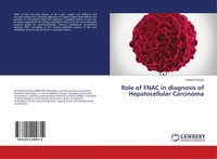 Role Of Fnac In Diagnosis Of Hepatocellular Carcinoma Fakeha Firdous