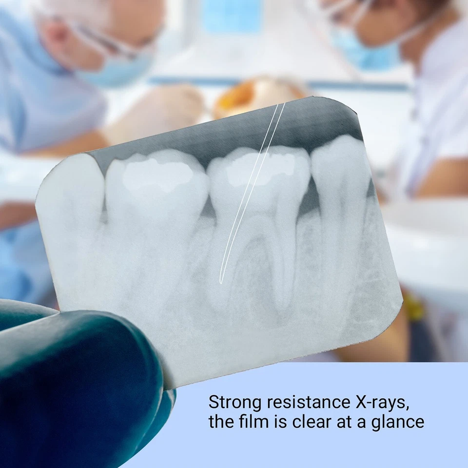 AZDENT puntas de gutapercha canal radicular endodoncia dental con escala - Image 4 of 4