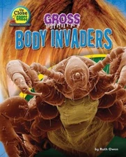 Gross Body Invaders by Owen, Ruth