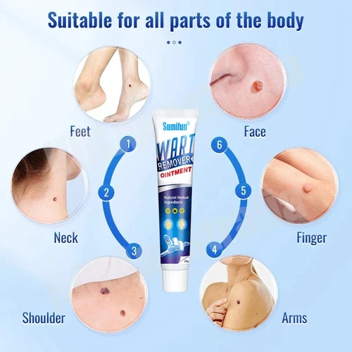 Sumifun Wart Remover Ointment – Fast Acting Natural Herbal Cream for Skin Warts - Picture 3 of 10