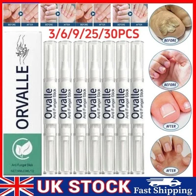 Orville Nail Fungus Pen Anti Fungus Infection Nail Care Repair Pen Toenail -2026