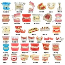 Multiple Types Dental Teeth Model Ortho Implant Practice Teaching Demo Models