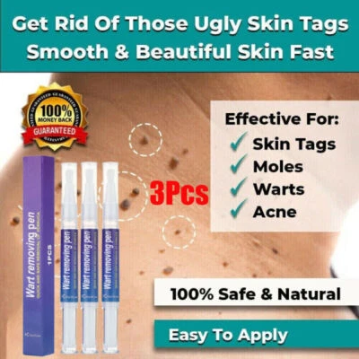 3PACK 12 Hours Wart Remover Pen Skin Tag Mole Remover Eliminate Foot Corn Warts