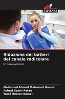 Riduzione Dei Batteri Del Canale Radicolare Wael Hussen Kamel