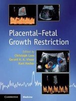 Christoph Lees (U. A.) | Placental-Fetal Growth Restriction | Buch | Englisch