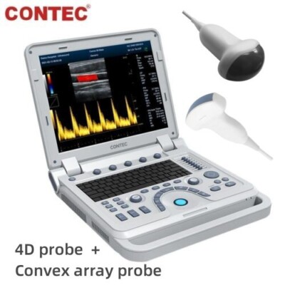 CONTEC CMS1700B Color Doppler Ultrasound Scanner 4D+convex array Abdominal Probe