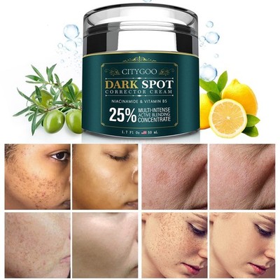 CITYGOO Dark Spot Remover for Face: Dark Spot Corrector Cream - Enriching Skin