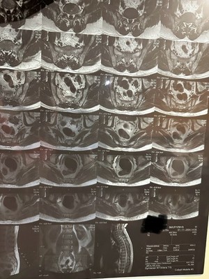Original Vintage Krankenhaus Mensch Röntgen MRT Scan Tomographie Original Acetat Film12