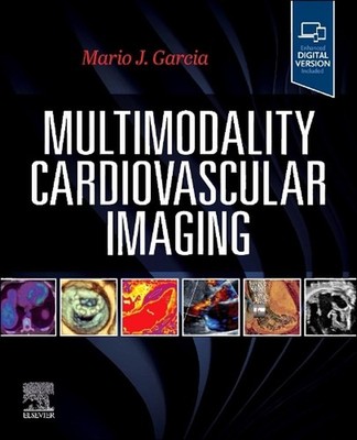 Multimodality Cardiovascular Imaging by Mario J. Garcia Paperback Book