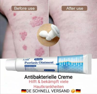 20g Haut Psoriasis Creme Anti Dermatitis Ekzem Ekzem-Salbe Behandlung Creme