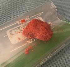 Hot Fries Dust Ball