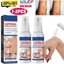 Lipomheilung Reduction Spray, Instant LumpFree Lipoma Removal Spray