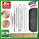 8PCS Blackhead Whitehead Pimple Spot Comedone Extractor Remover Popper Tool Kit
