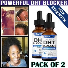 DHT Blocker-Alfatradiol Hair Growth Serum Anti Hair Loss Care - PACK OF 2