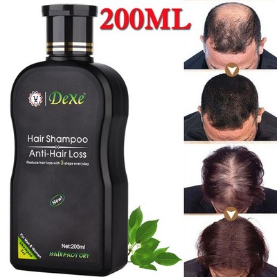 Hair Growth Shampoo Hair Regrowth Treatment Anti-Hair Loss Shampoo For Men Women