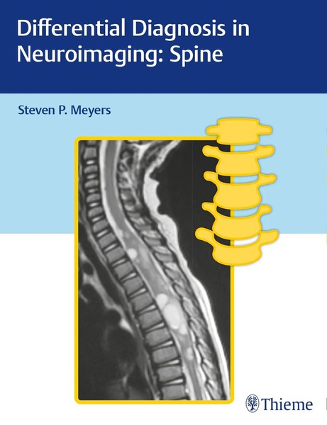Differential Diagnosis In Neuroimaging: Spine | Steven Meyers | Englisch | Buch-image
