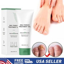 Nutraboost Nail Fungus Treatment Gel,Antibacterial Nail Growth Repair Cream 20ML