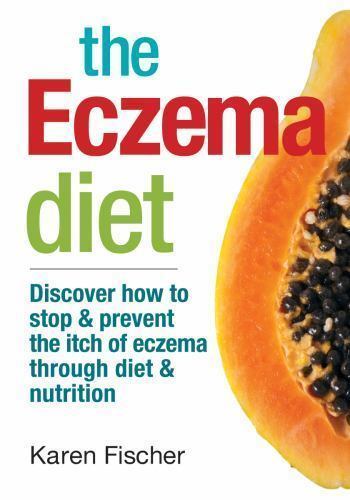 The Eczema Diet. (It Works!) - Picture 1 of 1
