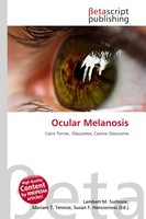 Lambert M. Surhone (U. A.) | Ocular Melanosis | Taschenbuch | Englisch (2026)