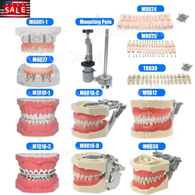 US Dental Overdenture Implant Model Preparation Training Teaching Ortho Typodont