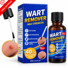 40 Salicylic Acid Wart Remover Liquid for Common, Plantar  Flat Warts Blue