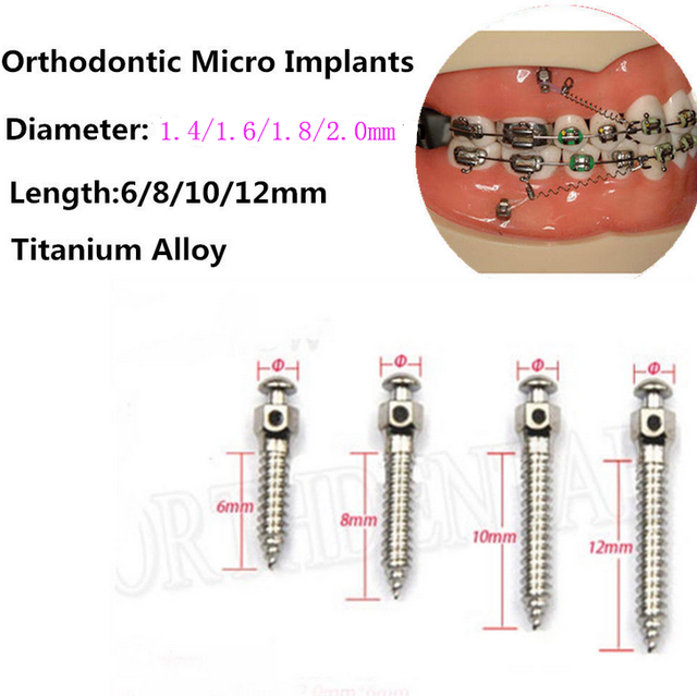Dental Ortho Anchorage Micro Implant Mini Anchor Screws Titanium 6mm 8mm 1012mm eBay
