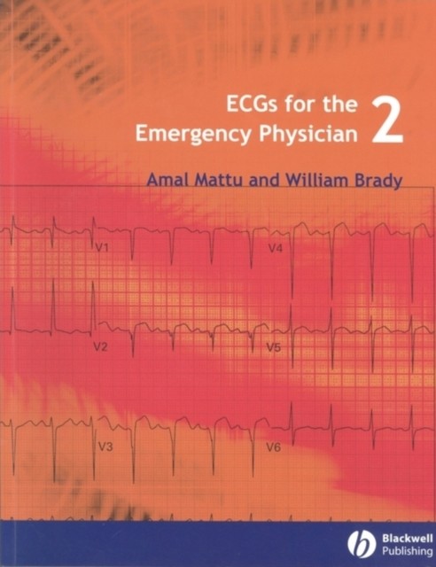 ECGs for the Emergency Physician 2e Mattu Paperback Wiley–Blackwell