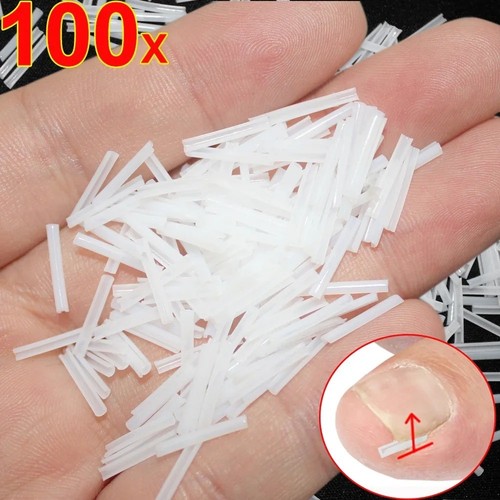 100Pcs Ingrown Toenail Corrector Toe Foot Nail Correction Sticker Pedicure Tool - Afbeelding 6 van 11