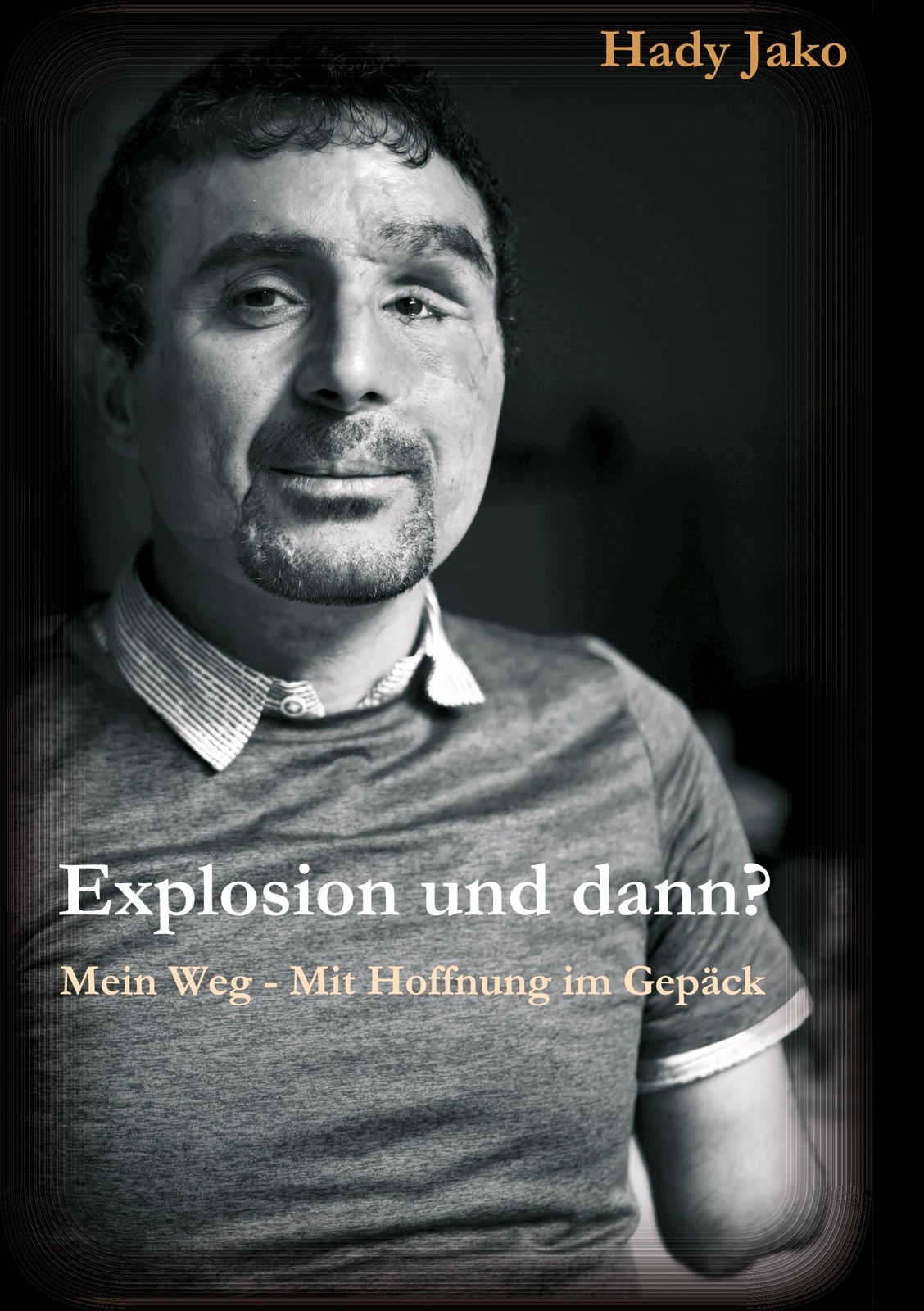 Explosion Und Dann? Mein Weg - Mit Hoffnung Gepäck | Buch |