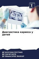 Diagnostika Kariesa U Detej Bhushan Pustake (U. A.) Taschenbuch Russisch 2022