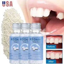 3 Sets Tooth Repair Beads Granules Temporary Moldable Dental Pellets False Teeth