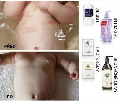 Hanfprodukte: CBD Und Seine Anwendungen