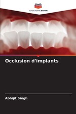 Occlusion dimplants Abhijit Singh