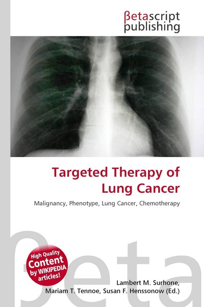 Targeted Therapy Of Lung Cancer Lambert M. Surhone-image