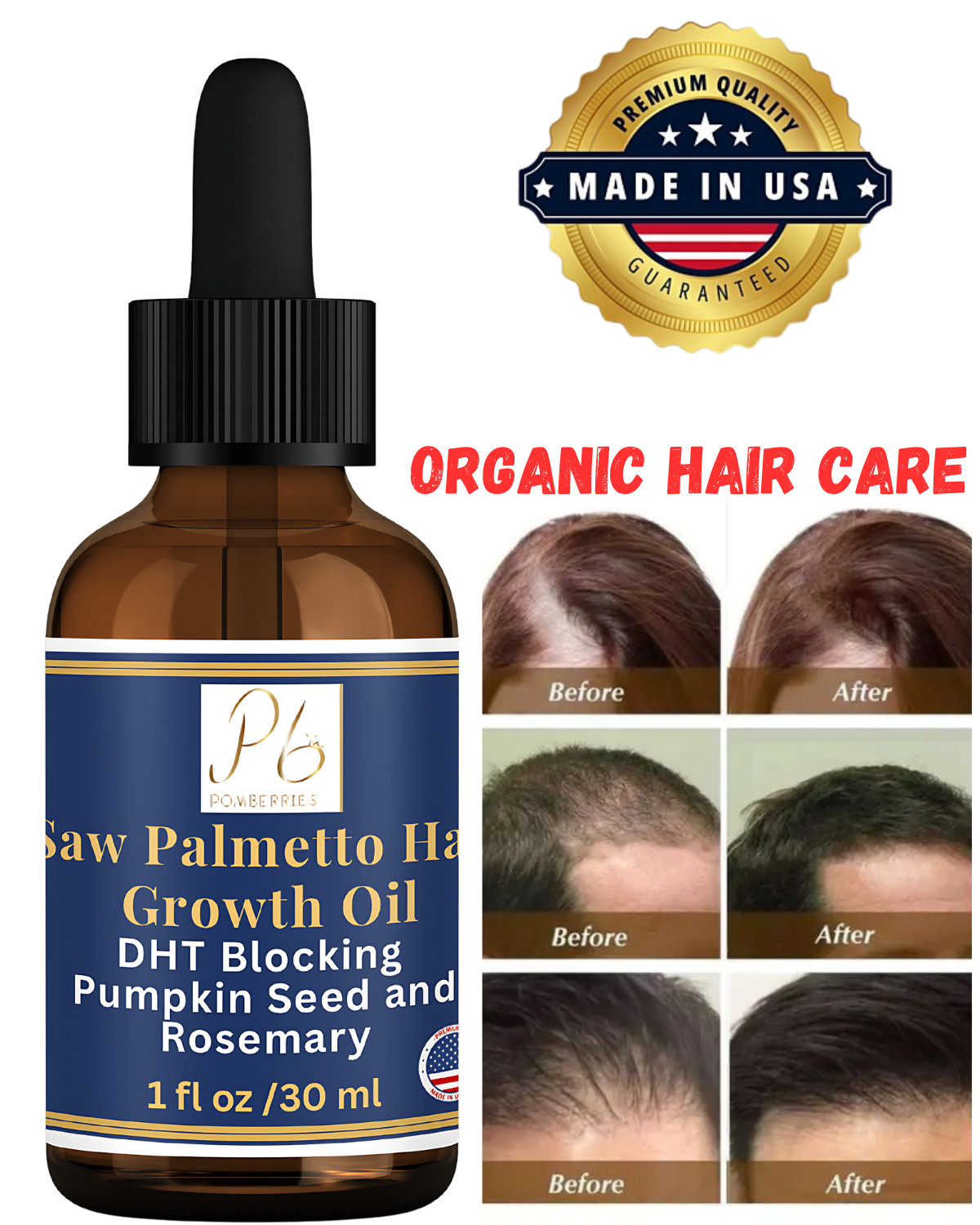 For Prevent Hair Loss Rosemary Pumpkin Seed Oil For Hair Gro