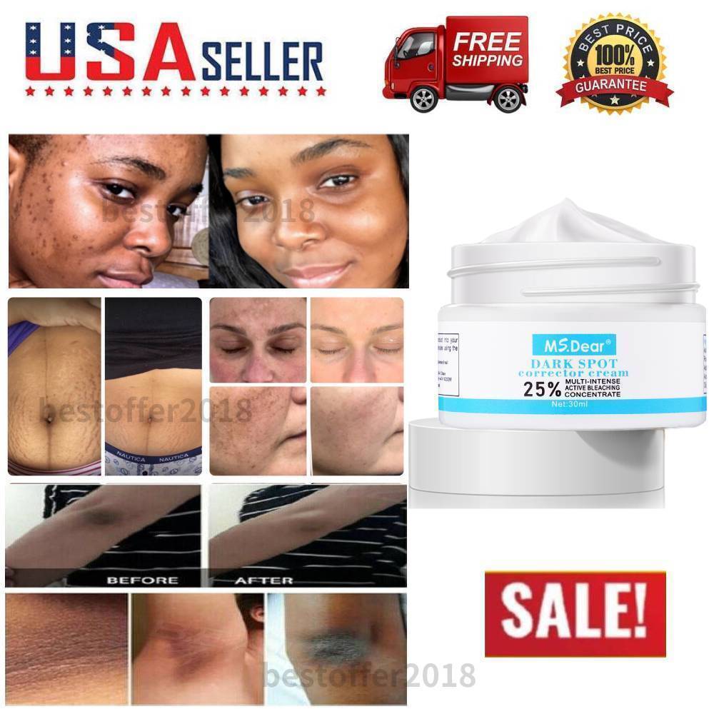Best Black Spot Removal Cream