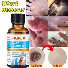 HEALMUSZ Wart Remover Liquid Plantar Wart Removers for Feet Body Fast Acting 30g