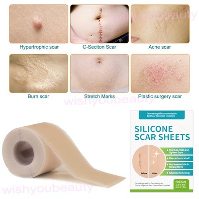 Collagen Scar Tape Sheets Tape Roll For Sensitive Skin Face Wrinkles (1.5/3/6M)