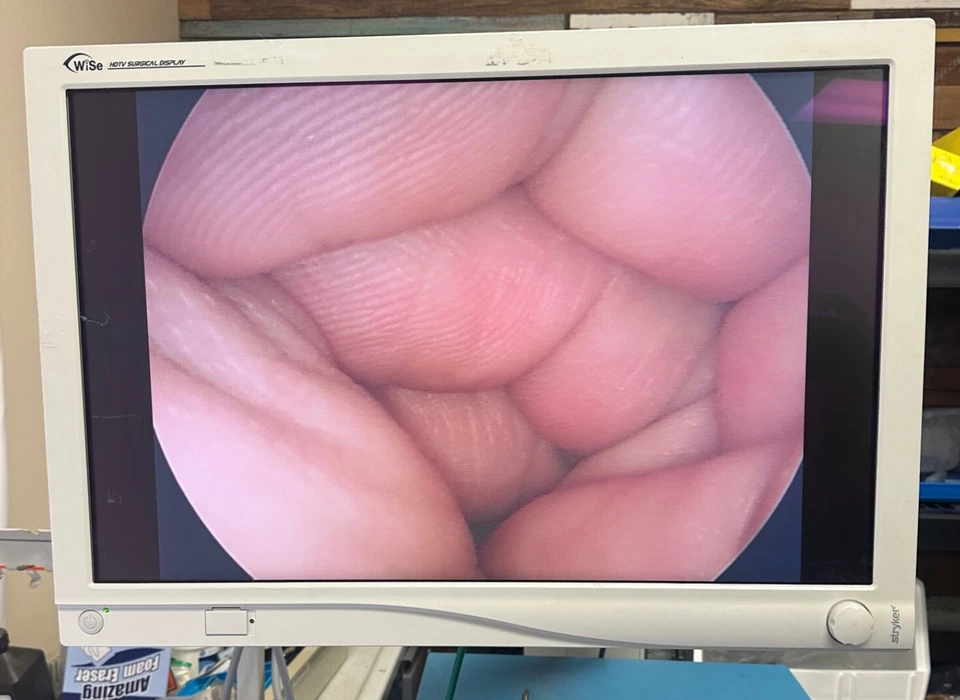 Laparoscopio autoclavable Olympus WA50372B 5,4 mm x 0º x 33 cm HD Foto 2 de 4