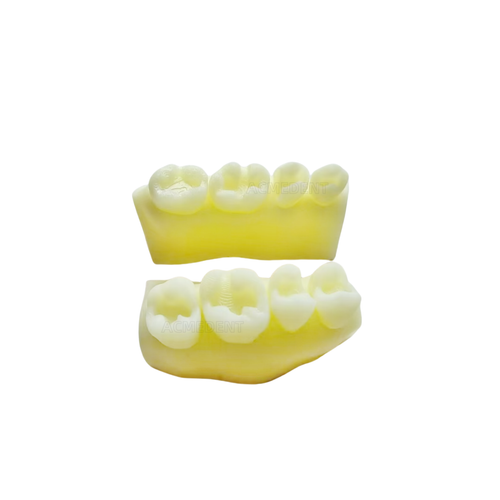 Composite Resin Restore Model Dental FIT With Cavifil IPS Empress Student Test - Picture 3 of 6