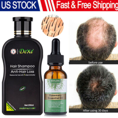 200ML Dexe Hair Growth Shampoo Natural Herbal Anti Hair Loss Treatment Serum Oil
