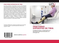 Fracturas Expuestas DE Tibia Ana Carranza SáNchez