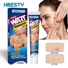 HBESTY Wart Removal Ointment | Easy-to-Use | Fast Results | Bestselling Care Sol