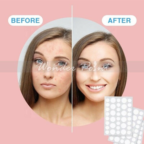 36pcs Acne Dots Pimple Patches Cystic Acne Patch Hydrocolloid Acne Spot Sticker - Picture 4 of 12