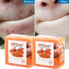 2PCS Tumeric Soap Skin Whitening Dark Spots lightening Acne Brightening Turmeric