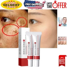 2 Pcs Whitening Freckle Cream - Brightening Melasma & Blemish Treatment