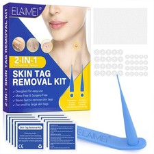 2 in 1 Natural Painless Auto SKIN TAG Removal kit Skin tag bands Remover Device