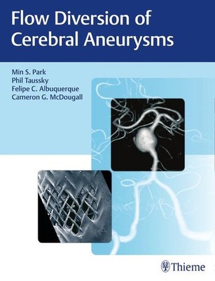 Flow Diversion of Cerebral Aneurysms | englisch